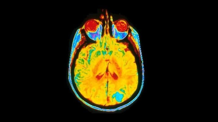A single image of a human brain using a magnetic resonance imaging (MRI) machine. Image courtesy of Dr Leon Kaufman. University Of California, San Francisco