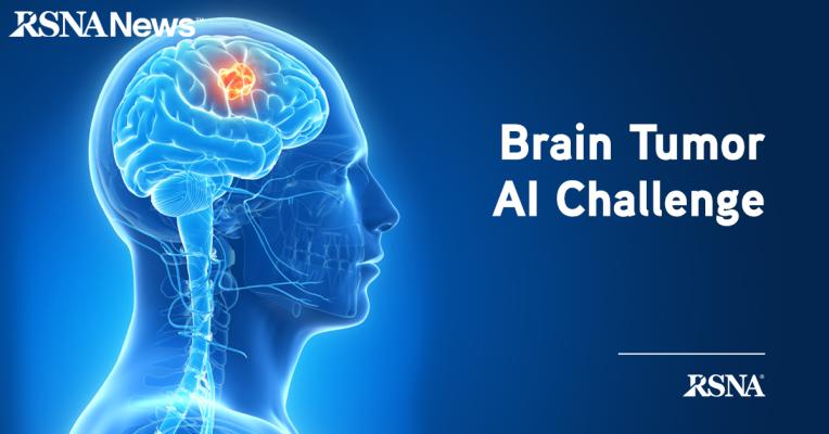 The results of a unique two-tiered brain tumor AI challenge were announced today by the Radiological Society of North America (RSNA), Medical Image Computing and Computer Assisted Interventions Society (MICCAI), and the American Society of Neuroradiology (ASNR), who partnered to conduct the challenge. Researchers developed AI models to perform two different tasks using a single dataset of brain magnetic resonance imaging (MRI) scans in competitions staged on separate platforms.