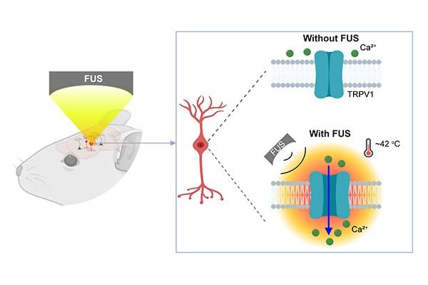 A multidisciplinary team at Washington University in St. Louis has developed a new brain stimulation technique using focused ultrasound that is able to turn specific types of neurons in the brain on and off and precisely control motor activity without surgical device implantation. 