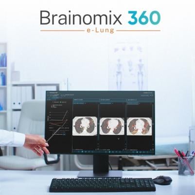 Brainomix, Endeavor BioMedicines Present Positive AI Imaging Results in IPF Clinical Trial