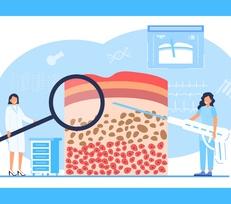 Study Finds Imaging Technique Can Reduce Benign Breast Biopsies by 25%