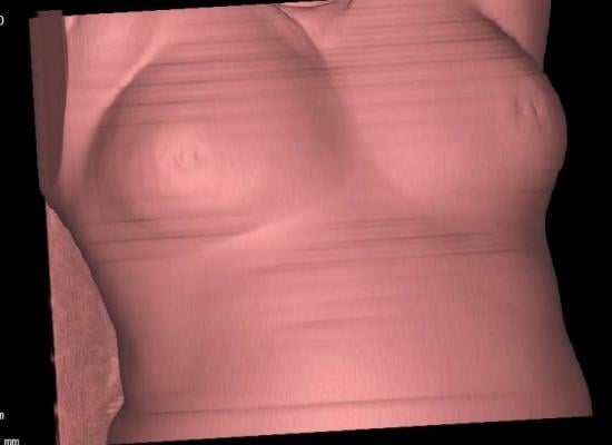 New study examines use of breast tomosynthesis. Marilyn Fornell