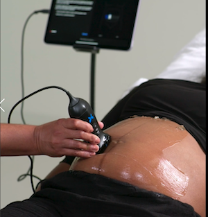 ultrasound, gestational, portable