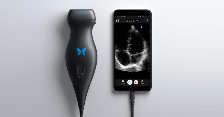Butterfly iQ devices provide revolutionary portable ultrasound capabilities for faster and easier screening and monitoring