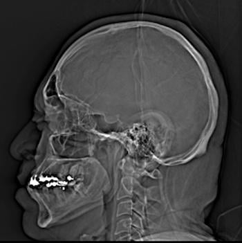 Study Shows Number of Head CT Scans in ERs More than Doubles Over 15 Years