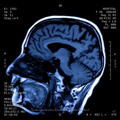 New Study Evaluates Head CT Examinations and Patient Complexity