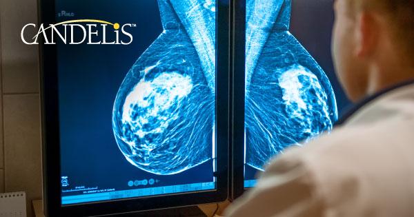 Candelis, Inc. recently launched the Advanced Breast Imaging Workstation as an enhancement to its ImageGrid platform