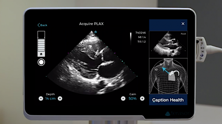 The Caption Guidance software uses artificial intelligence to guide users to get optimal cardiac ultrasound images in a point of care ultrasound (POCUS) setting.