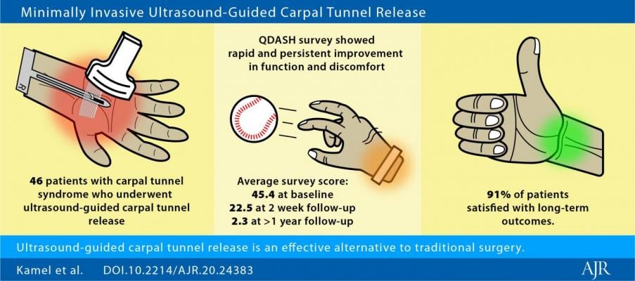 Ultrasound-guided carpal tunnel release quickly improves hand function and reduces hand discomfort, making the procedure a safe, effective, and less invasive alternative to traditional open or endoscopic surgery