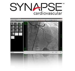 Synapse Cardiovascular version