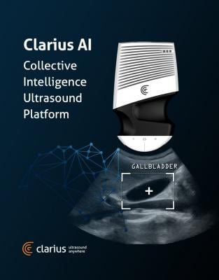 Clarius Mobile Health Announces Clarius AI Collective Intelligence Ultrasound Platform