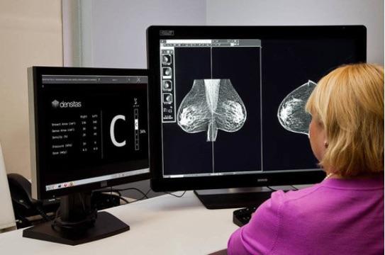 Densitas Enters Partnership Agreement With TeleMammography Specialists