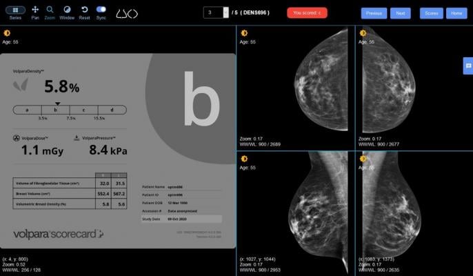 Radiologists around the world will have access to a first-of-its-kind online breast density training tool designed to improve radiologists' ability to correctly identify women's breast density categories to comply with the Breast Imaging-Reporting and Data System (BI-RADS), thanks to a collaboration between DetectED-X and Volpara Health. 