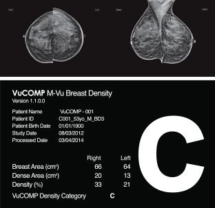 VuCOMP Mammography M-Vu Breast Density M-Vu Cad Turkey