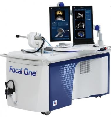 Houston Methodist Hospital Acquires Focal One High-Intensity Focused Ultrasound System