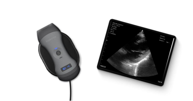 EagleView ultrasound introduced its wireless portable ultrasound device, which provides ultrasound imaging much freedom, and makes the point-of-care solution more affordable too