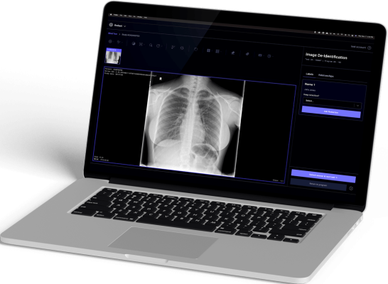 Infinitt will deploy Enlitic’s Endex data standardization solution in conjunction with the Infinitt PACS to help radiologists and the enterprise