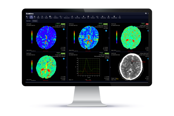Clinically validated MR brain perfusion images support earlier diagnosis, guidance of tumor biopsies, and post-surgical monitoring 