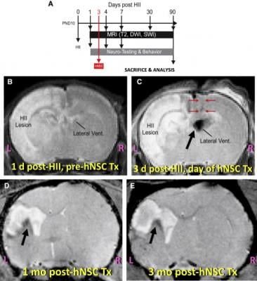 Experimental Protocol and Representative MRI of Brains at Various Key Points in That Protocol.