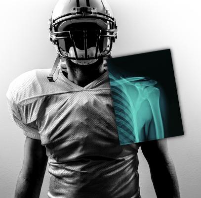 Carestream, 2015 NFL Combine, DRX-1, UBMD, digital radiography, X-ray, DR