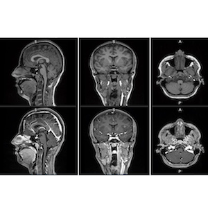 mri, contrast agent, FDA