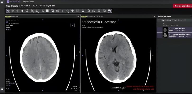 GE HealthCare's Genesis portfolio Now Available in AWS Marketplace