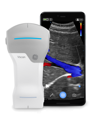 GE Healthcare unveiled a major digital update for Vscan Air, its cutting-edge, wireless handheld pocket-sized ultrasound device that provides crystal clear image quality, whole-body scanning capabilities, and intuitive software - all in the palm of clinicians’ hands. 