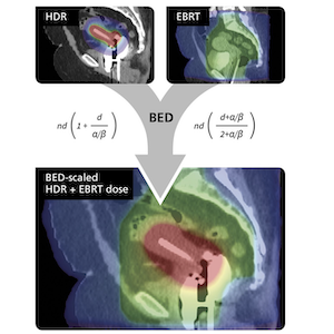 molecular imaging, gynecologic cancer