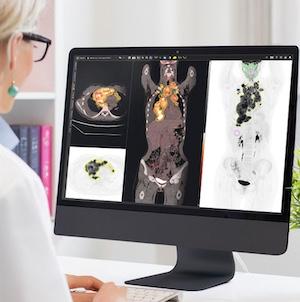 GE HealthCare Submits Modeling Software for FDA Approval