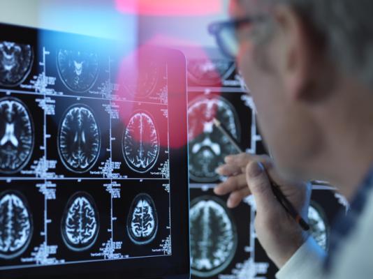 The American College of Radiology (ACR) Center for Research and Innovation (CRI) will serve as the operations center for the new Alzheimer’s Network for Treatment and Diagnostics (ALZ-NET)  