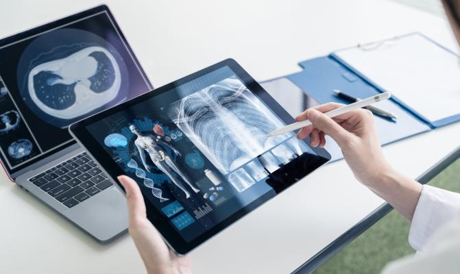 The global X-ray devices market is estimated to grow at a CAGR of 5.14% from a market size of USDX10.793 billion in 2019 to a market size of USD14.580 billion by 2025