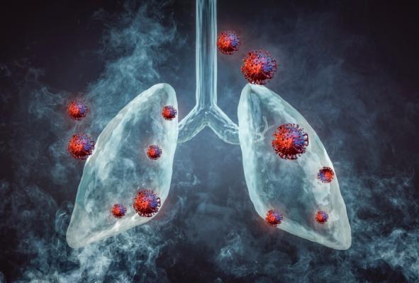 Nearly one quarter of deaths from lung cancer could be avoided in high-risk populations through the adoption of targeted screening with low-dose computed tomography (LDCT) scans, as based on the results of the NELSON study.