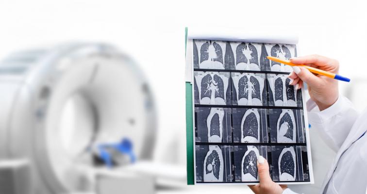 Volpara Health, a global health technology software leader providing an integrated platform for the delivery of personalized breast and lung care, further expanded its footprint in the US lung screening market with a strategic relationship with Seattle-based lung AI company RevealDx. 