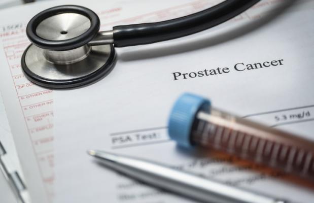 Evidence from VA medical centers nationwide supports benefits of prostate cancer screening