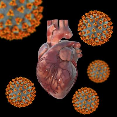 NIH supported study shows that the virus that causes COVID-19 can damage the heart without directly infecting heart tissue.