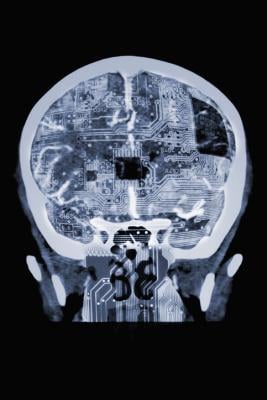 RSNA and four other radiology societies from around the world, including the American College of Radiology (ACR), have issued a joint statement on the development and use of artificial intelligence (AI) tools in radiology 
