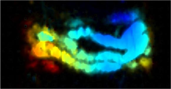 New Imaging Agent Provides Better Picture of the Gut
