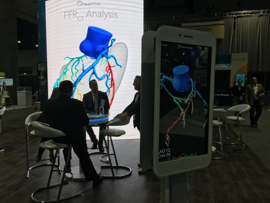 HeartFlow Analysis Successfully Stratifies Heart Disease Patients at One Year