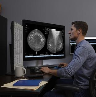Study: AI-Powered Mammography Technology Helps Flag Breast Cancer Cases Initially Interpreted as Negative 