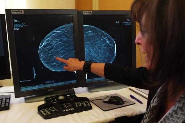 Georgia Becomes 38th State With Breast Density Inform Law