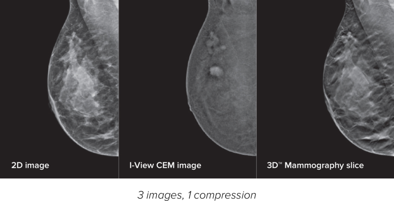 Partnership includes education and training to increase clinician confidence in the use of CEM, an emerging breast imaging modality 