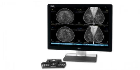 Collaboration will include data sharing, R&D and an upgrade of RadNet’s fleet of mammography systems to Hologic’s state-of-the-art imaging technology