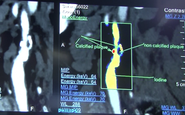 Spectral imaging of arteries