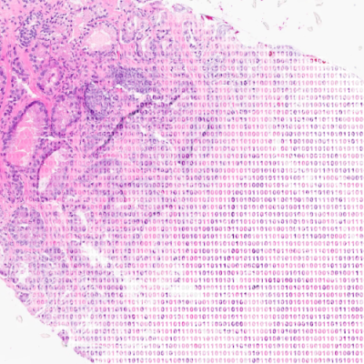 Paige, a provider of end-to-end digital pathology solutions and clinical AI, has announced a collaboration with Microsoft to build what they refer to as the world’s largest image-based AI models for digital pathology and oncology.