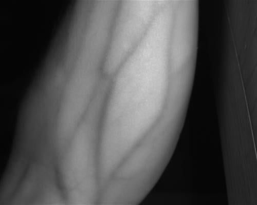 New Vascular Ultrasound Registry Looks to Enhance Patient Care