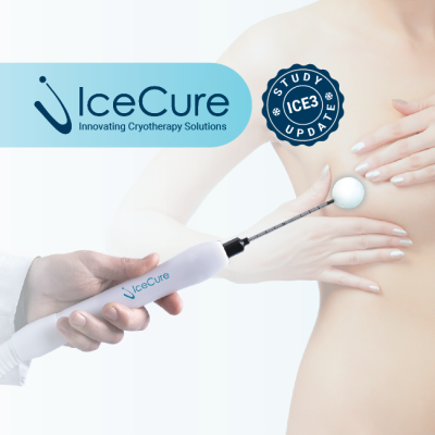 IceCure Medical Ltd., developer of minimally-invasive cryoablation technology, the ProSense System, that destroys tumors by freezing as an alternative to surgical tumor removal, announced that interim data from the ICE3 Clinical Trial on cryoablation of small, low-risk breast cancer was featured by Co-Primary Investigator Kenneth Tomkovich, M.D., at RSNA 2021.