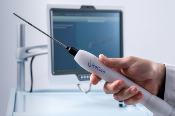 IceCure ProSense Cryoablation Receives FDA Marketing Authorization for Treating Low-Risk Breast Cancer in Women Aged 70+ 