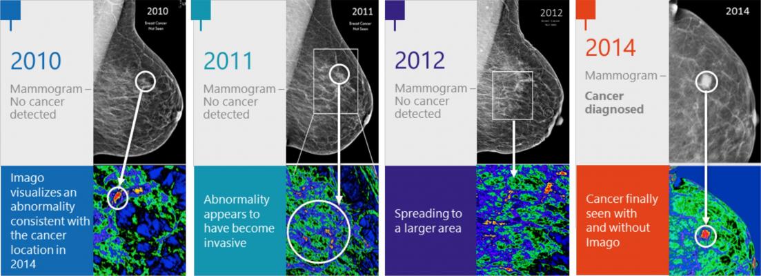 Imago Systems Announces Collaboration With Mayo Clinic for Breast Imaging