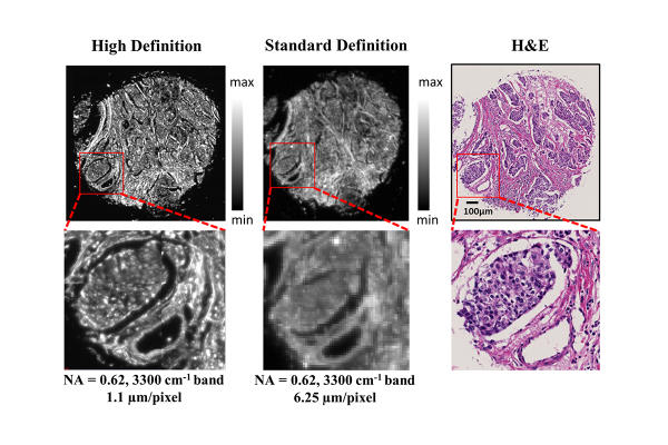 Comparisons of high definition and standard definition infrared imaging for digital histopathology. Image courtesy of the Beckman Institute