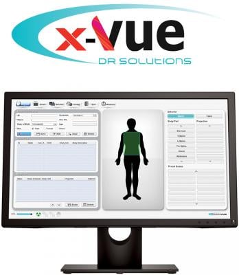 JPI Healthcare Solutions Installs CareRay X-Vue DR System at Ortho Northwest